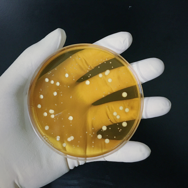 Lactobacillus